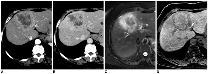 Fig. 11