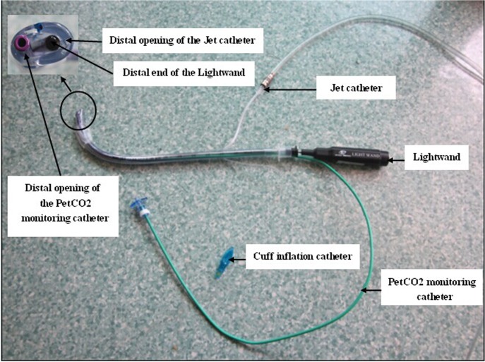 Fig 1