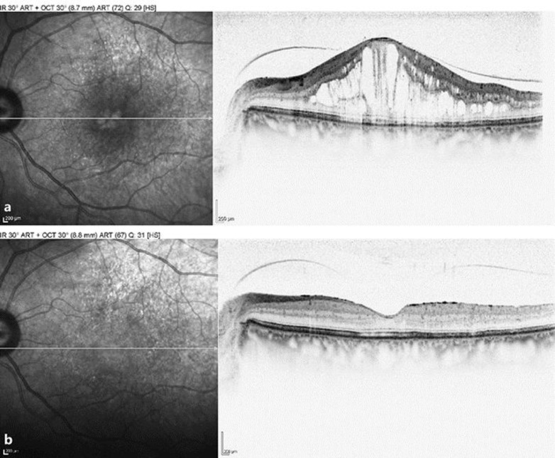 Fig. 2