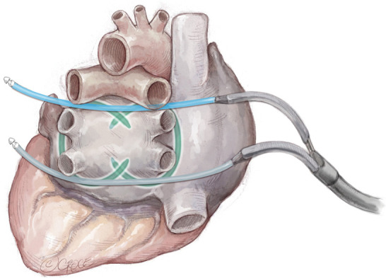 Figure 9