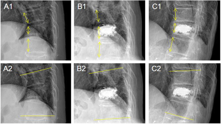 Fig. 2