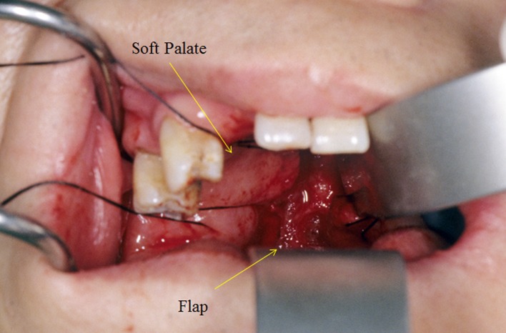 Fig. 2