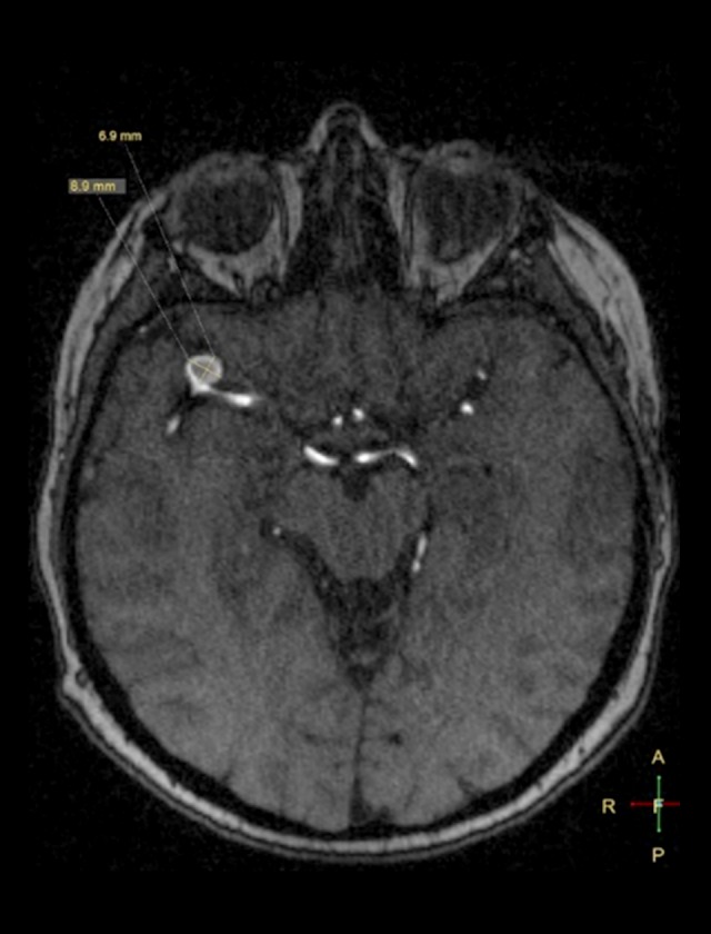 Figure 12