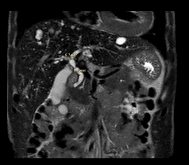 Figure 15