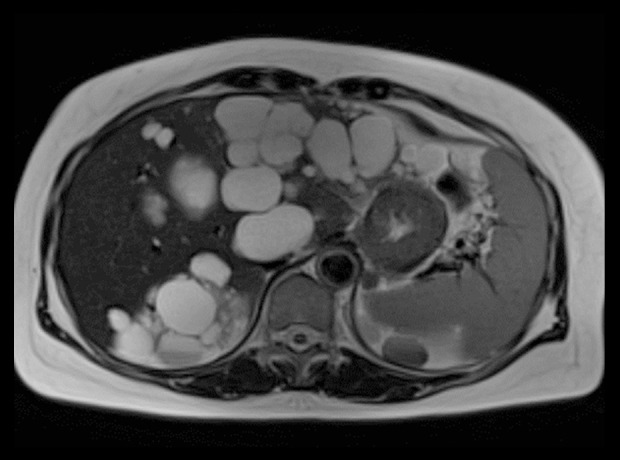 Figure 14