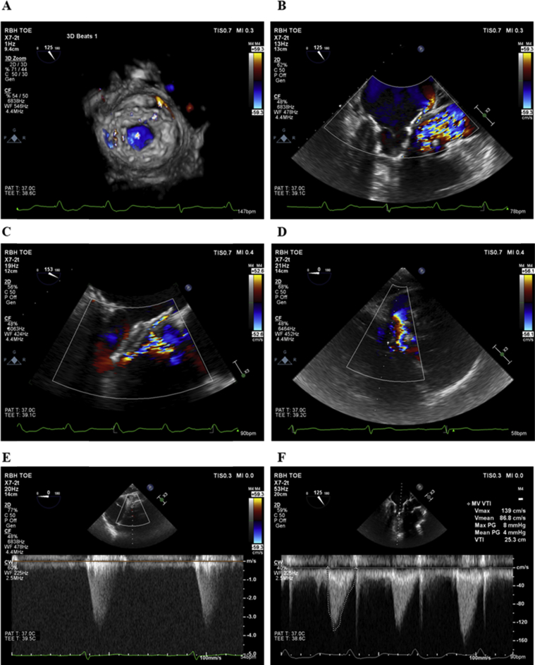 Figure 3