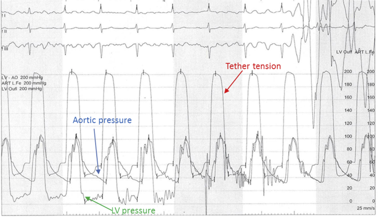 Figure 4