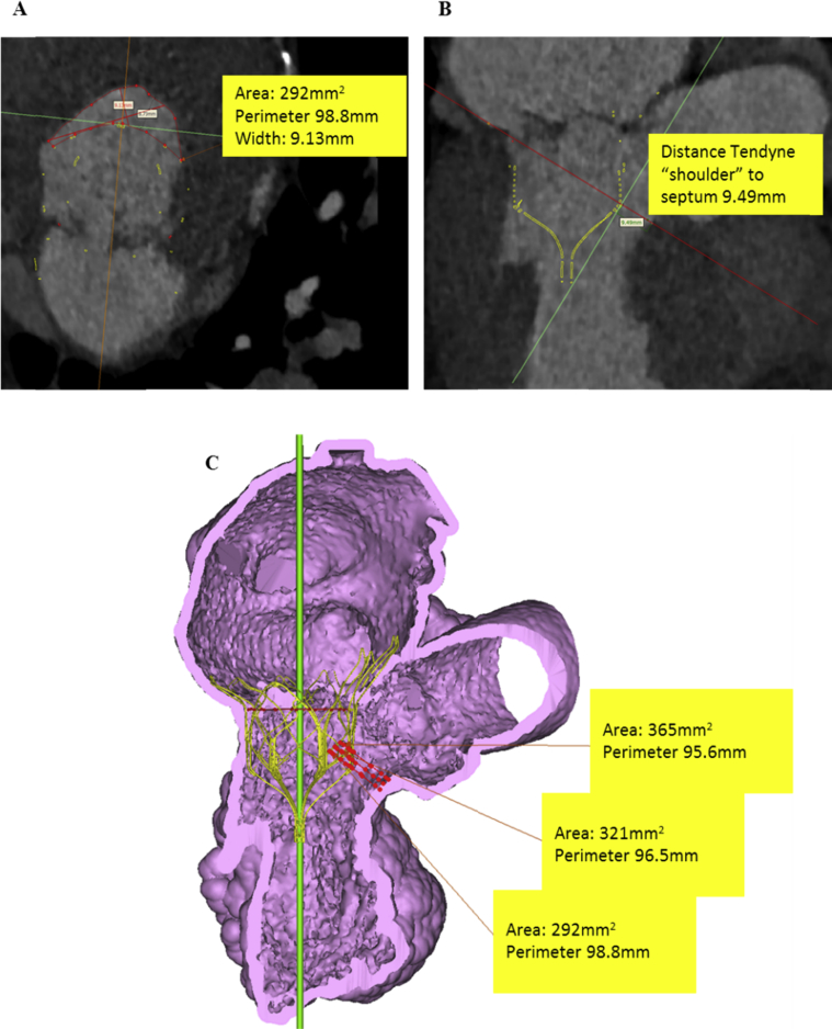 Figure 2