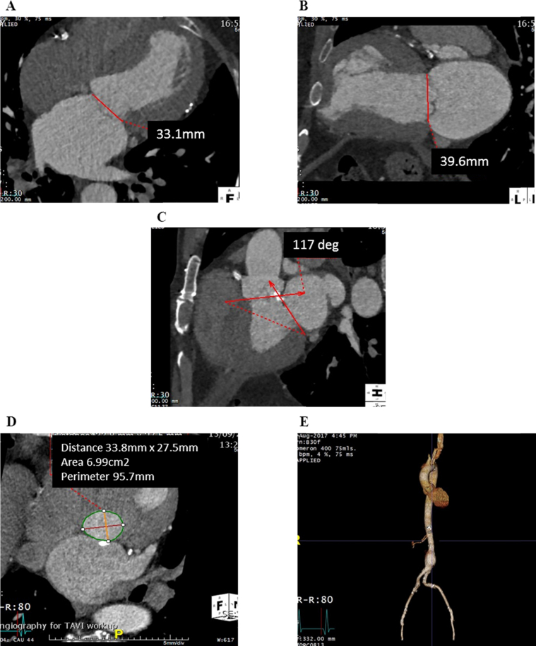 Figure 1