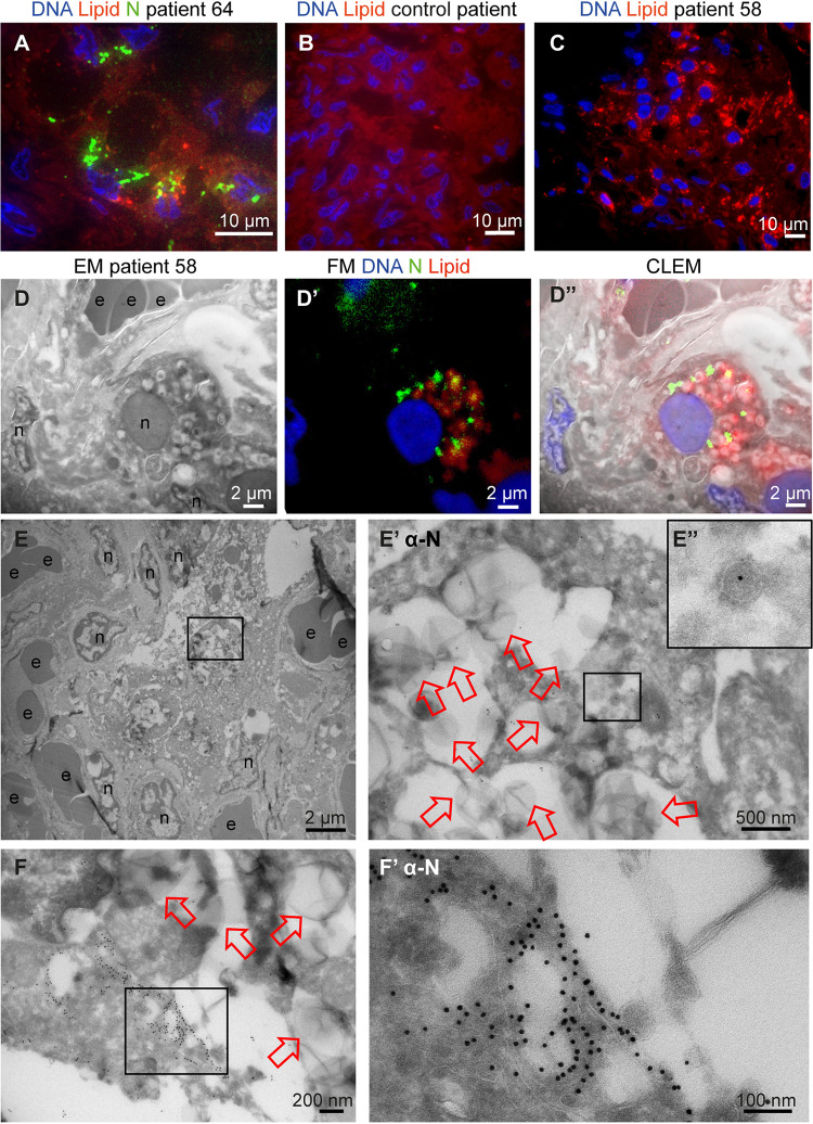 FIG 4