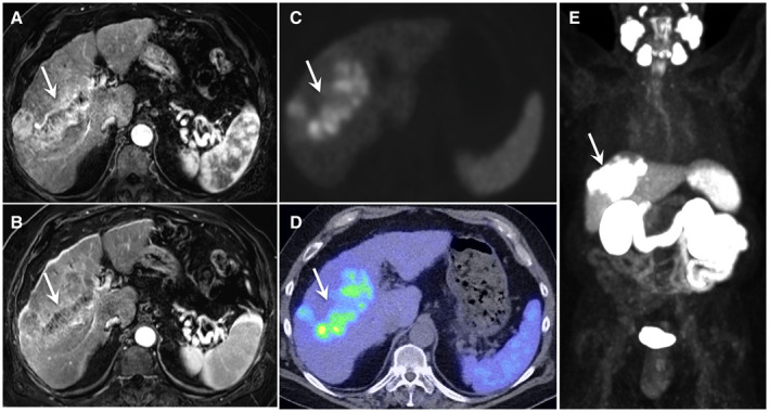 FIG. 3