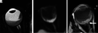 FIG 4.