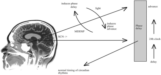 Fig. (1)