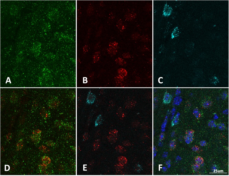 FIGURE 3