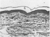 574-3
