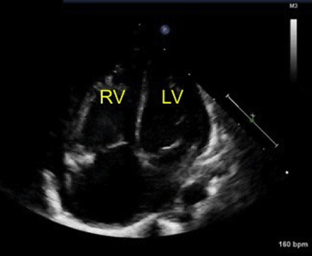 Figure 4