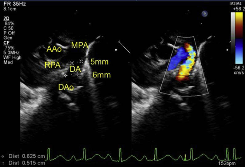 Figure 2