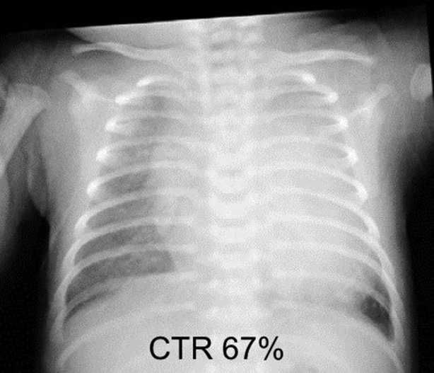 Figure 1