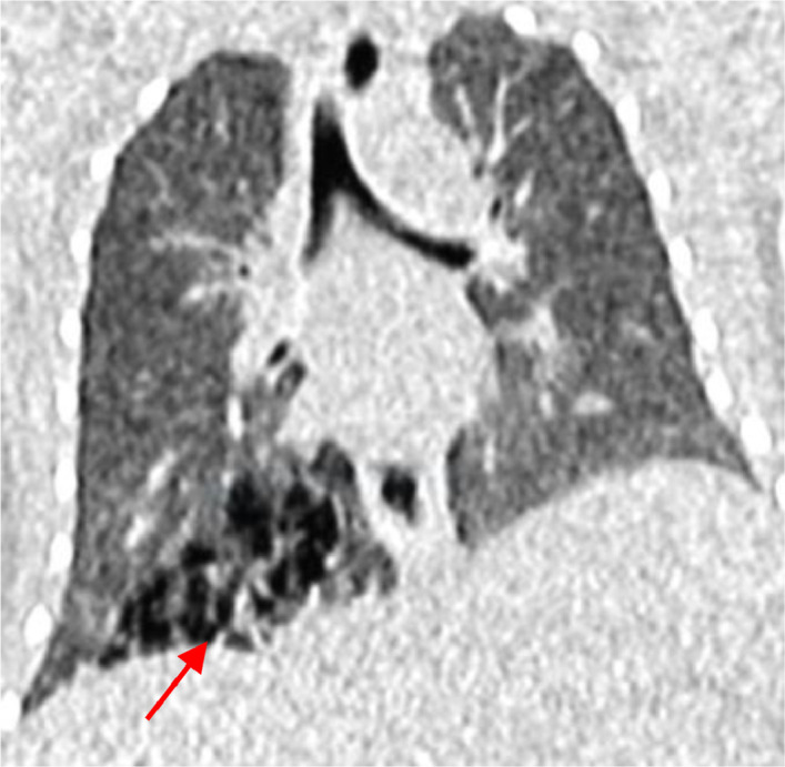 Fig 3: