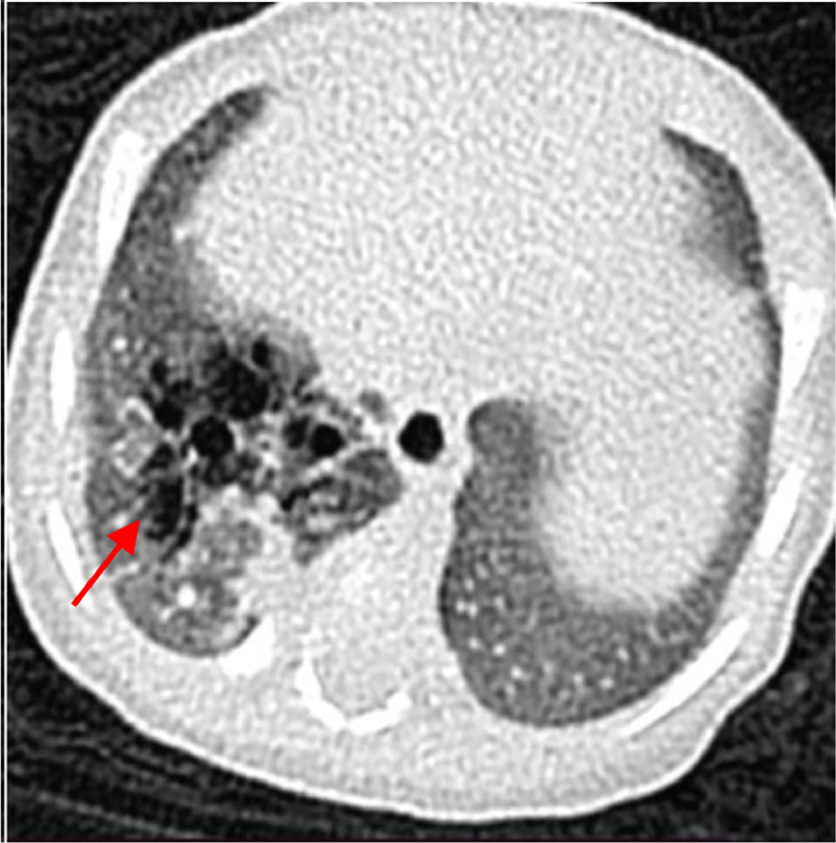 Fig 2: