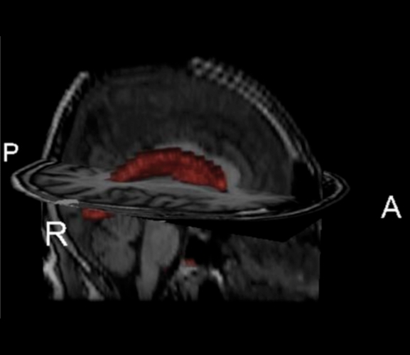 Figure 4.