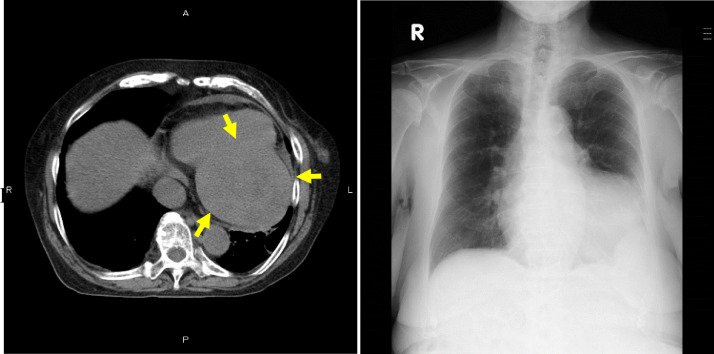 Fig 4