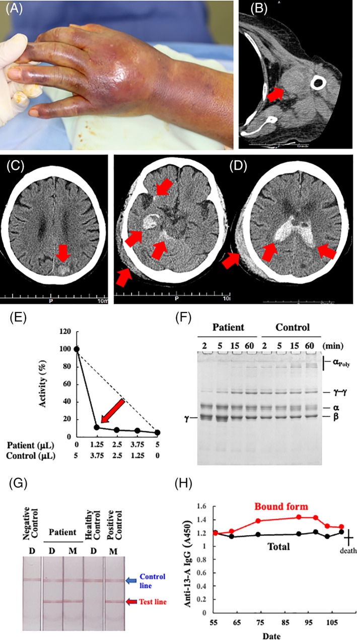 FIGURE 1