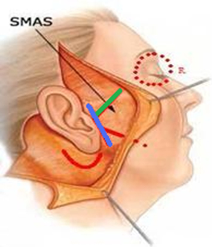 Fig. 1