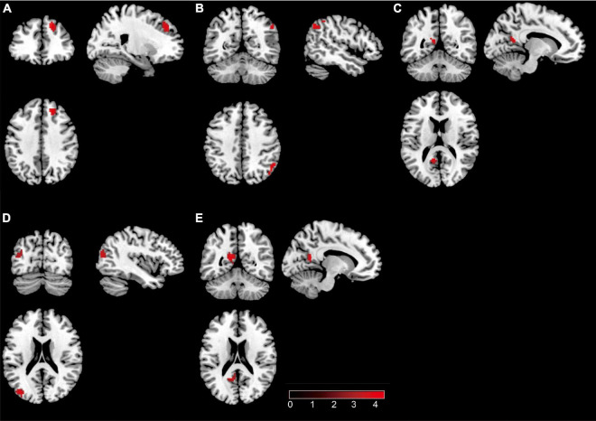 FIGURE 2