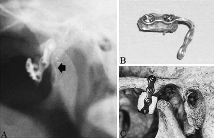 Fig. 2
