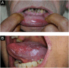 Figure 12
