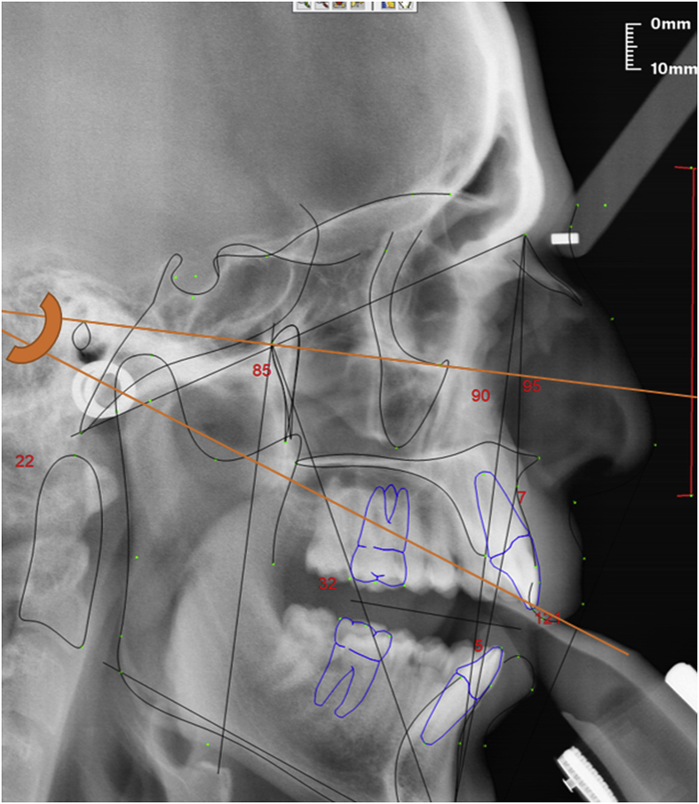 Fig. 7