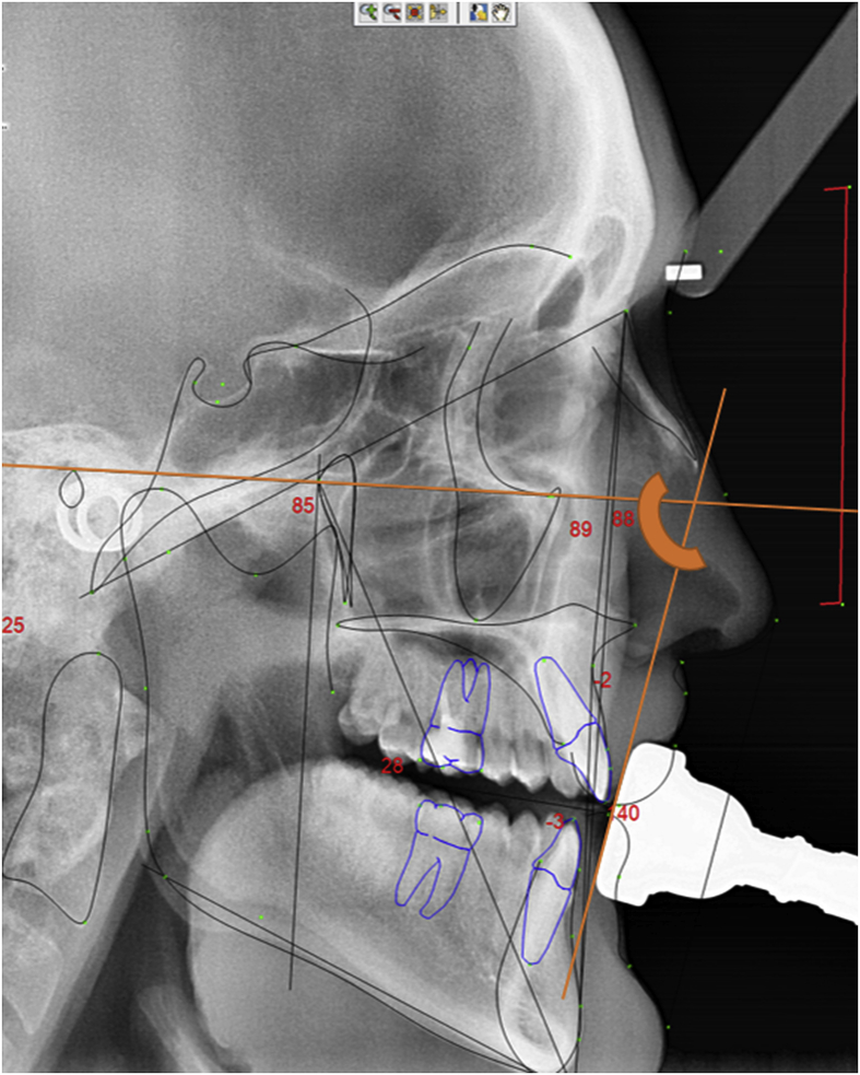 Fig. 10