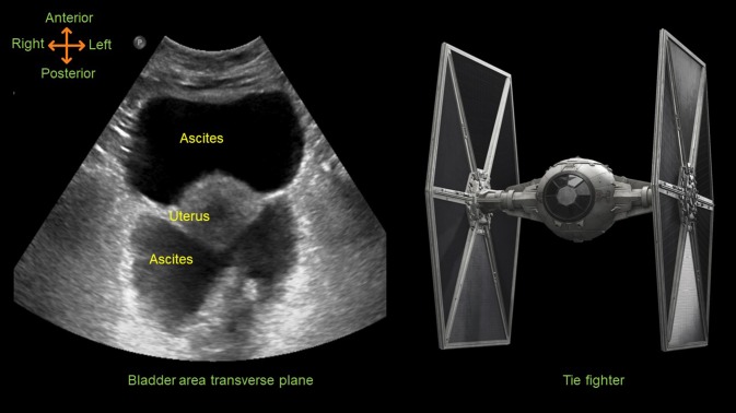 Fig. 1