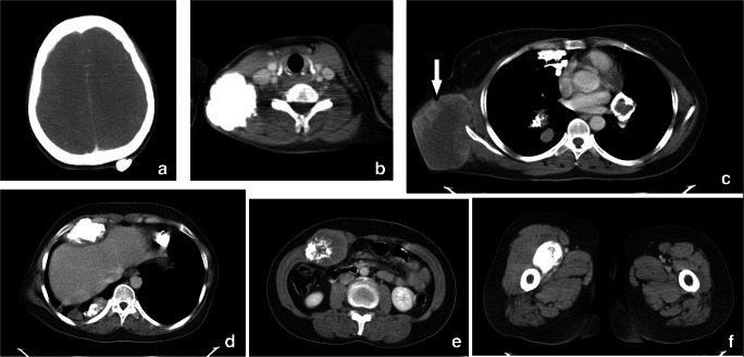 Fig. 2