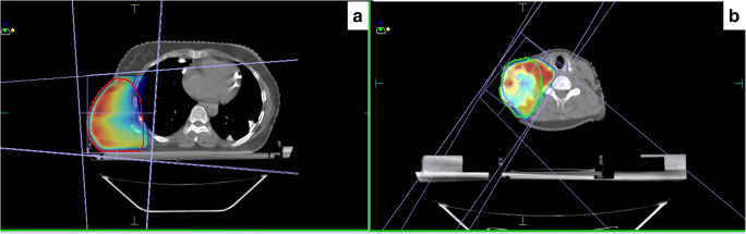 Fig. 4