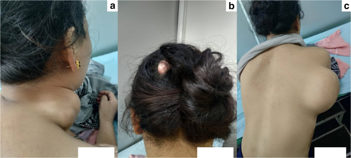 Fig. 1