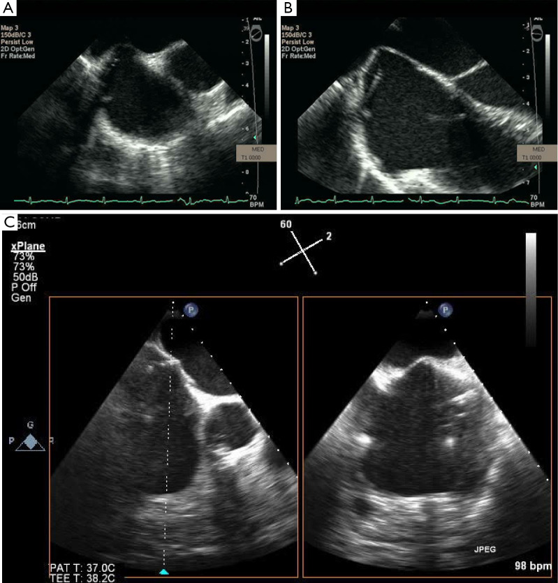 Figure 26