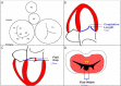 Figure 23