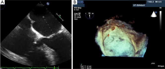 Figure 27