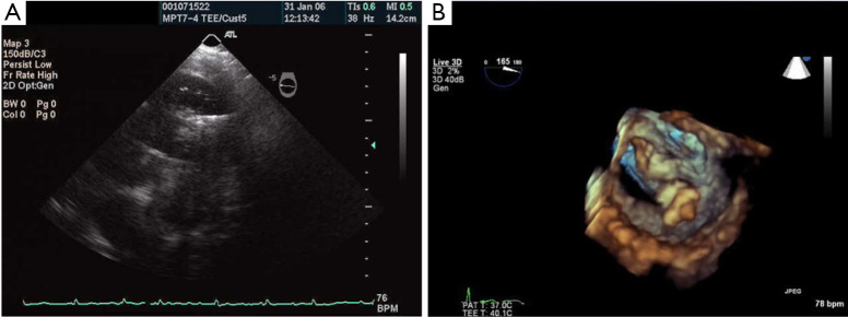 Figure 29