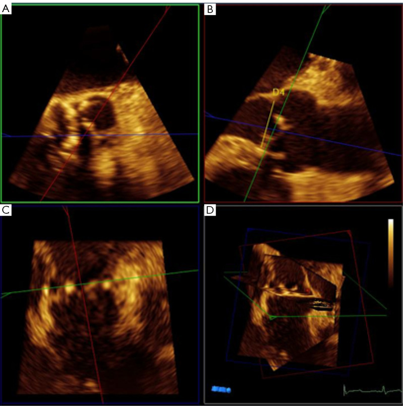 Figure 15