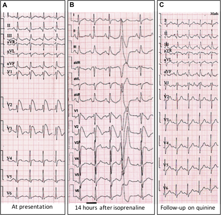 Figure 3