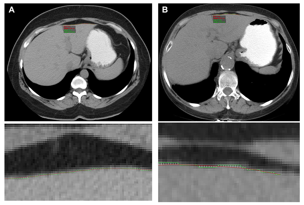 Fig. 9