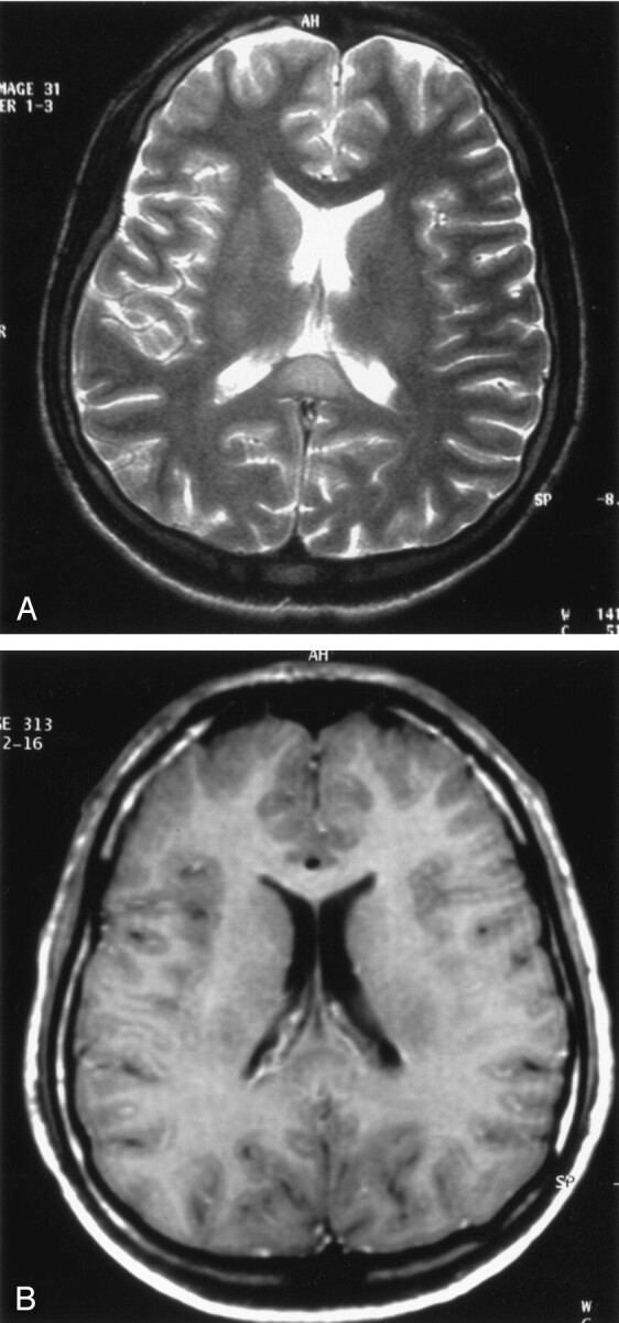 Fig 1.