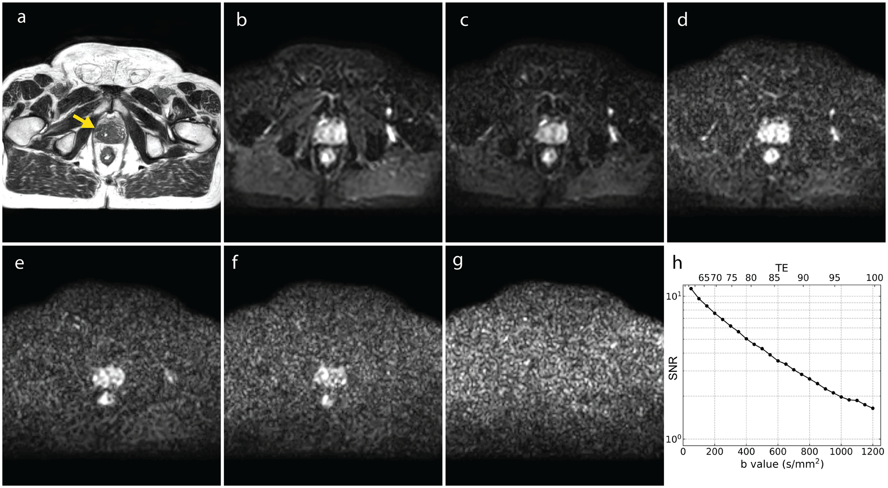 Adc Measurements On The Unity Mr-linac – A Recommendation On Behalf Of 