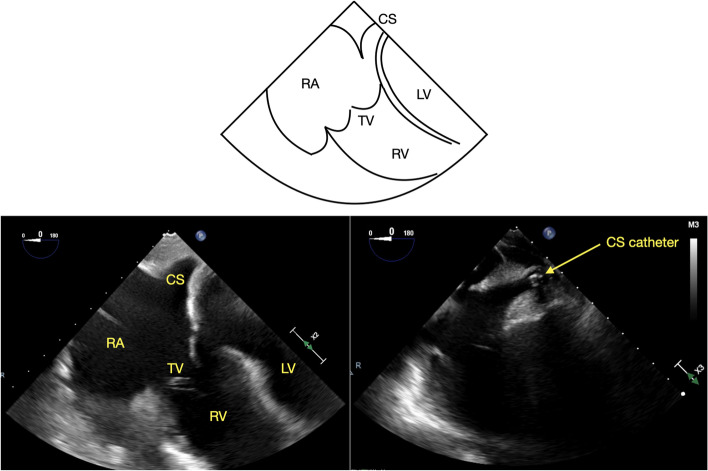 Fig. 1