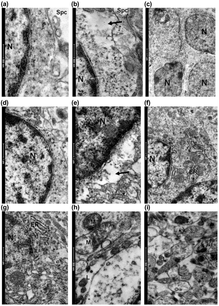 Prenatal Hyperhomocysteinemia Induces Glial Activation and Alters ...