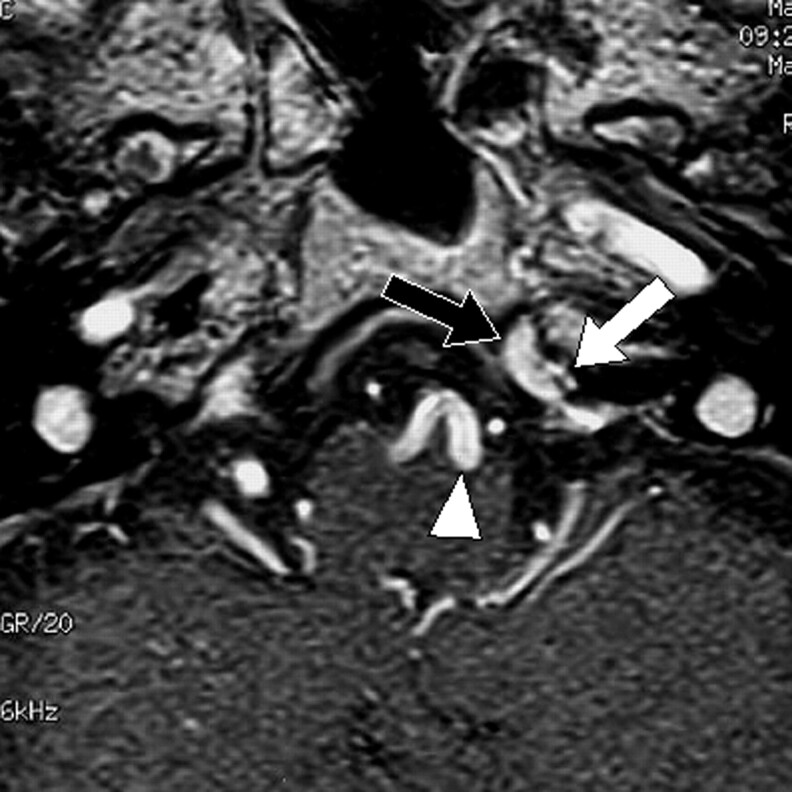 Fig 3.