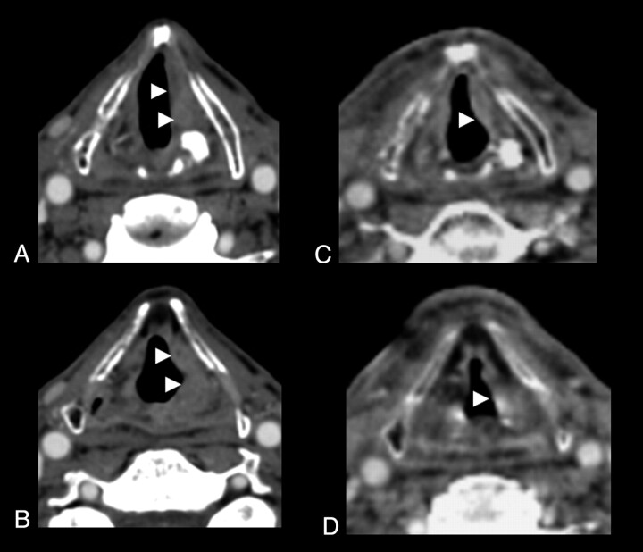 Fig 4.